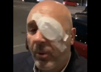 Με βουλωμένο μάτι εμφανίστηκε ο πρόεδρος που επιτέθηκε σε Γιουβέντους και Ομοσπονδία (vid)